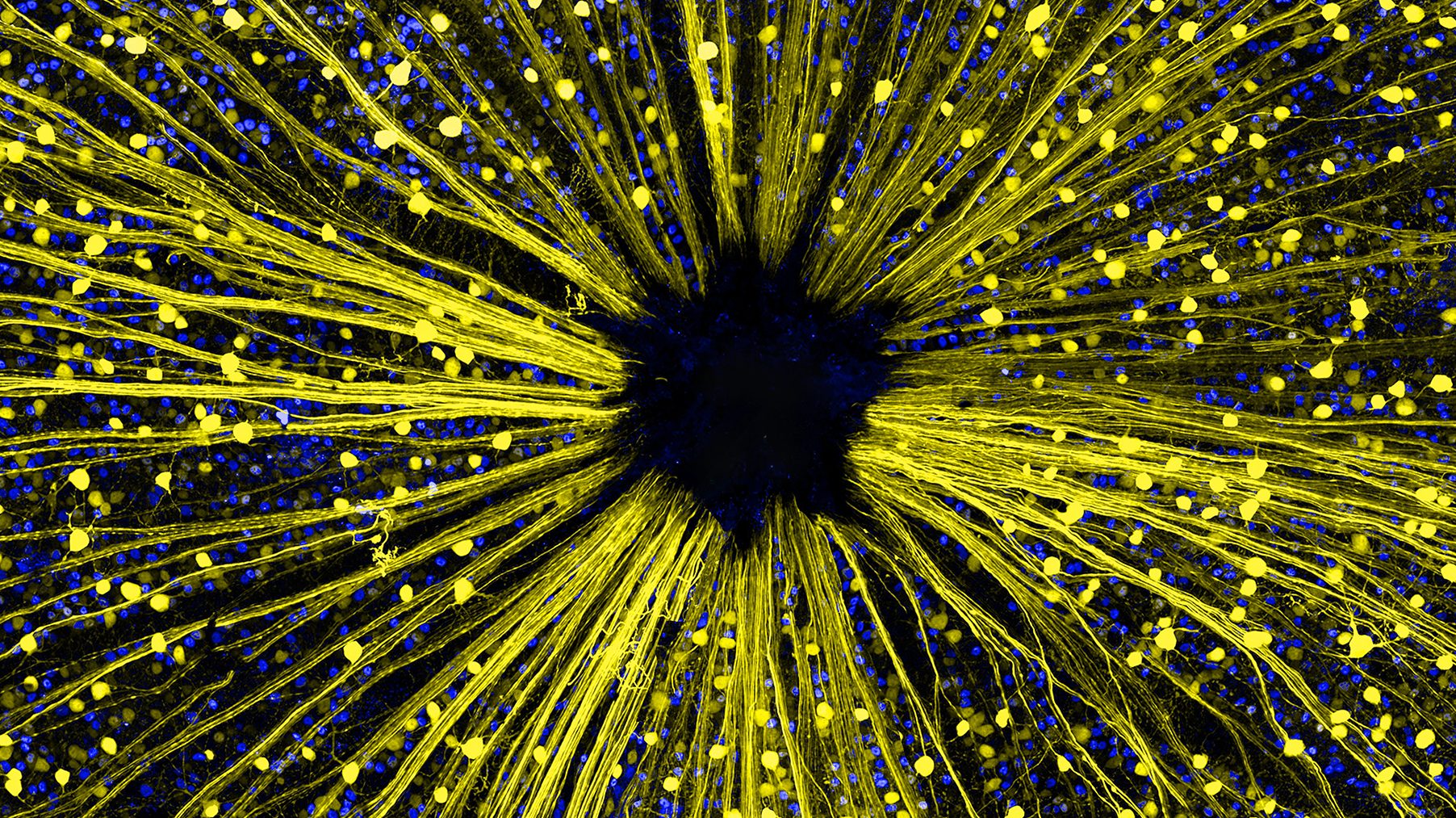 Mouse retinal ganglion cells (Dr. Keunyoung Kim)