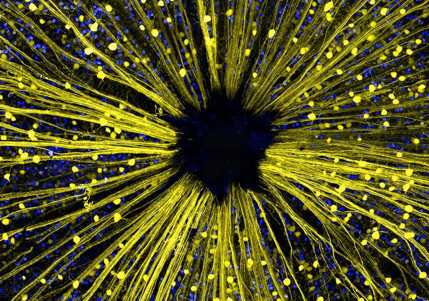 Mouse retinal ganglion cells (Dr. Keunyoung Kim)