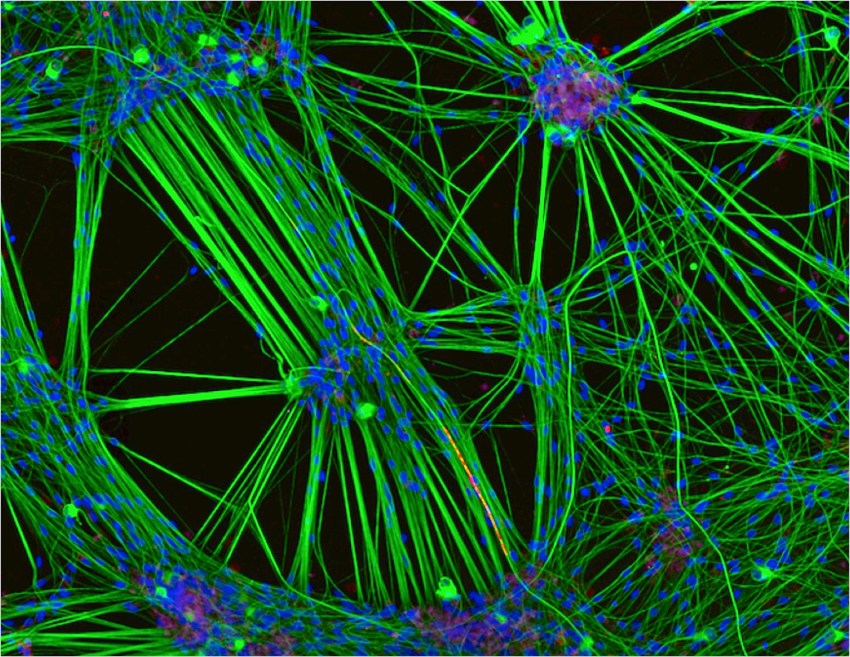 Culture of neurons, stained green, derived from human skin cells, and Schwann cells, a second type of brain cell, stained red (Rebecca Nutbrown)