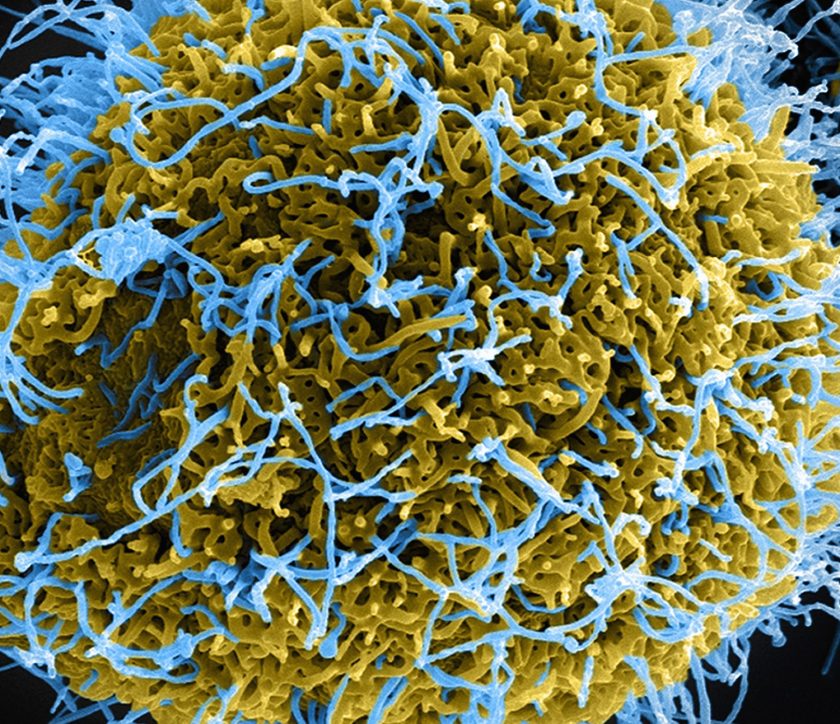 Filamentous Ebola virus particles, colored blue, budding from a chronically-infected VERO E6 cell, colored yellow (Getty Images)