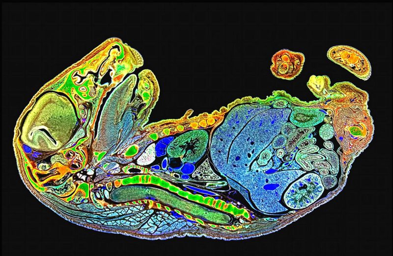 USA: Feature Rates Apply Mandatory Credit: Photo by SpikeWalker/RPS/Bournemouth/REX/Shutterstock (6047461ac) Mouse foetus, sagittal longitudinal section. Microscope images of creatures, vitamins, crystals, UK - Sep 2016 *Full story: http://www.rexfeatures.com/nanolink/srsr These incredible microscopic images of creatures, vitamins, crystals and even a fetus are to be recognised with an award from the Royal Photographic Society. Spike Walker has been fascinated by photomicrography since he got his first microscope just after the conclusion of the Second World War, when he was about 12-years-old. Now his life's passion is to be recognised with a Scientific Imaging Award from one of the world's oldest and prestigious photographic societies. The accolade is given to an individual for a body of photography which promotes public knowledge and understanding. The RPS said Spike's decades of work and immeasurable contribution to the field make him the perfect recipient.