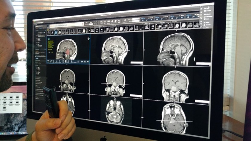 IBM demos AI and imaging at RSNA 2016, world's largest annual gathering of radiologists in Chicago. (IBM Watson Health)