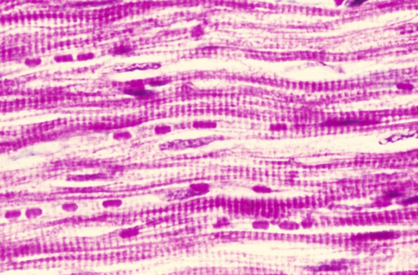 Cardiac Muscle