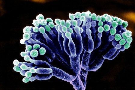 Microscopic image of Penicillium with spores