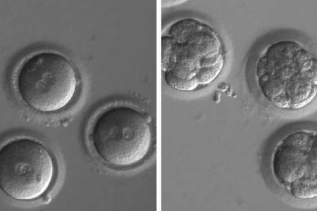 Gene Editing in Human Embryos