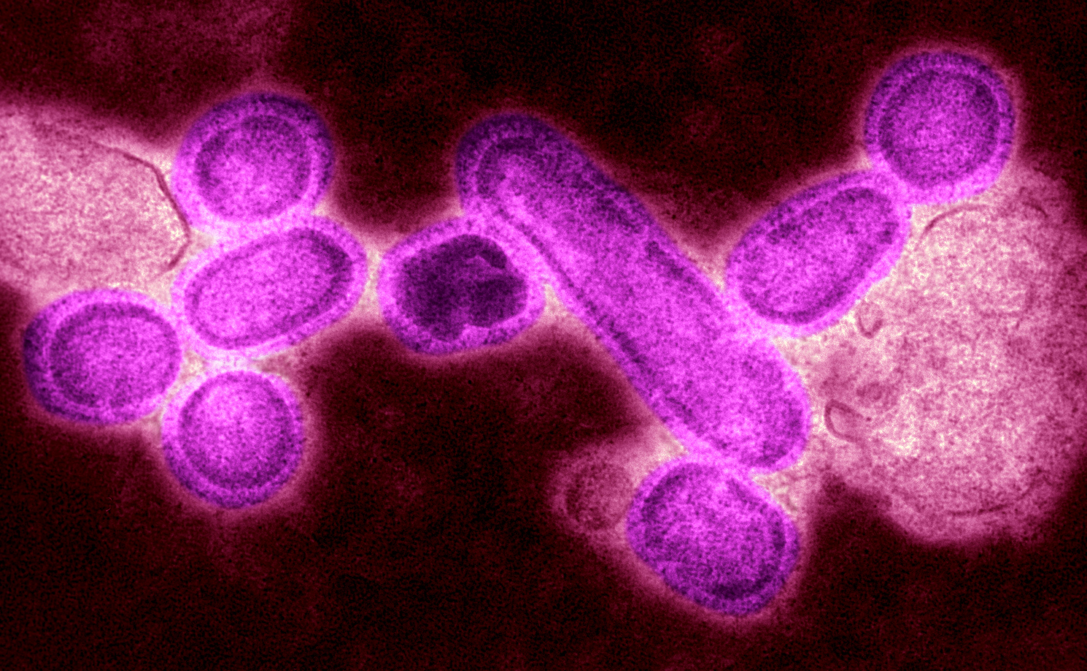 The flu virus. (Photo By BSIP/UIG Via Getty Images)