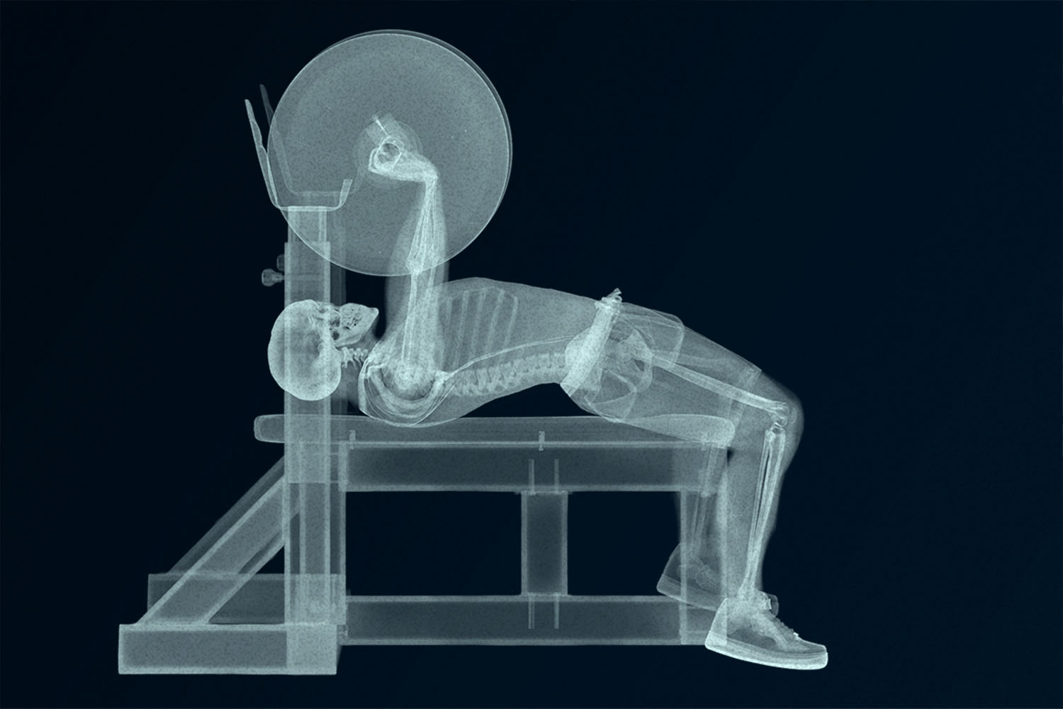 xray of man bench pressing