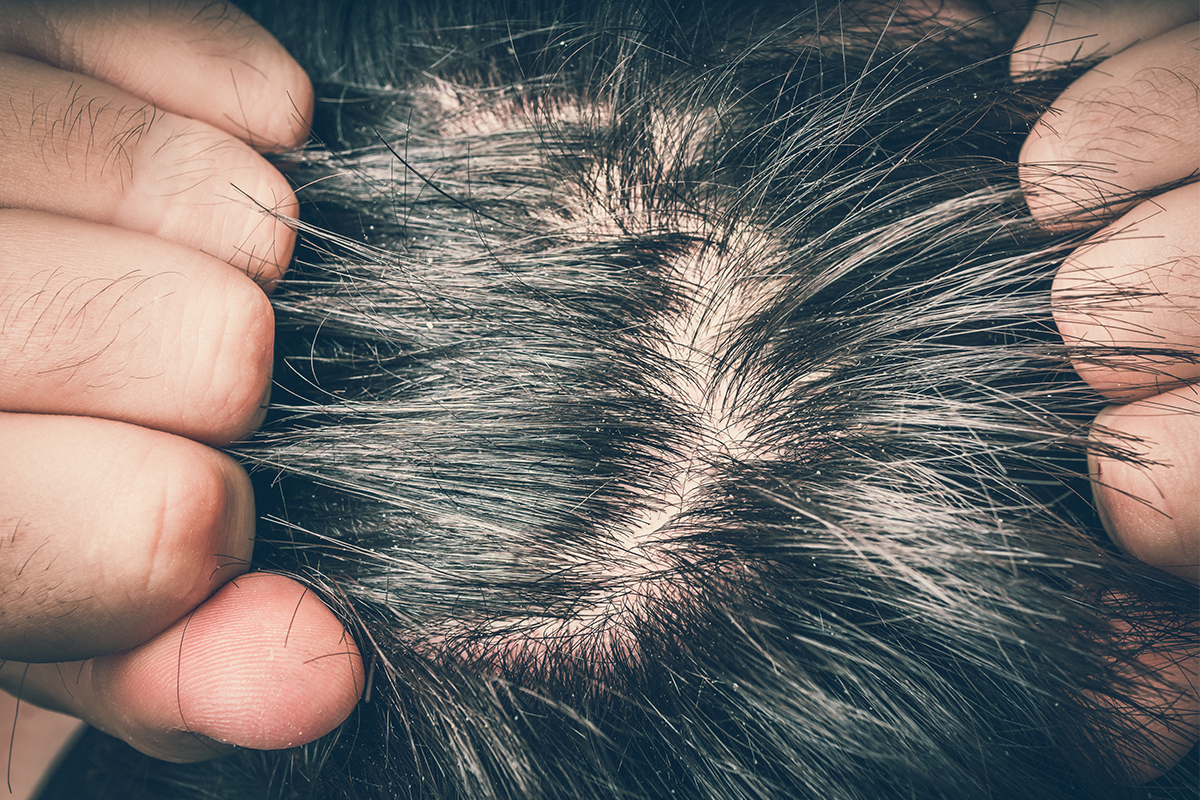 A man pulling on his hair from either direction.