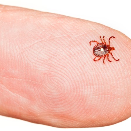 A lone star tick on the end of a finger. A bite from a lone star tick can cause alpha-gal syndrome, which makes humans allergic to red meat.