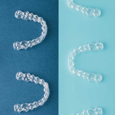 Four At-Home Aligners to Help Get Your Smile Back