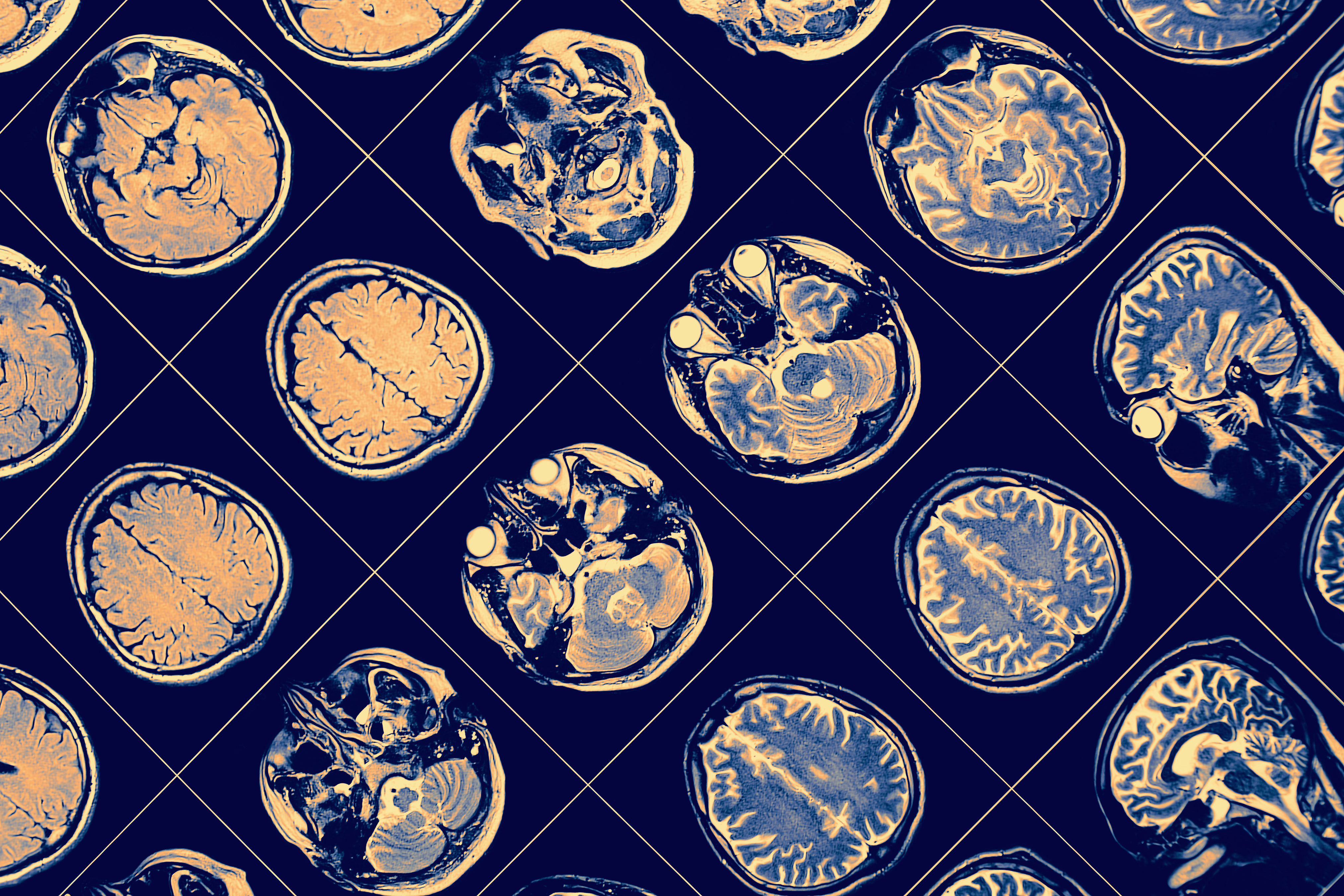 A creative image of various brain scans